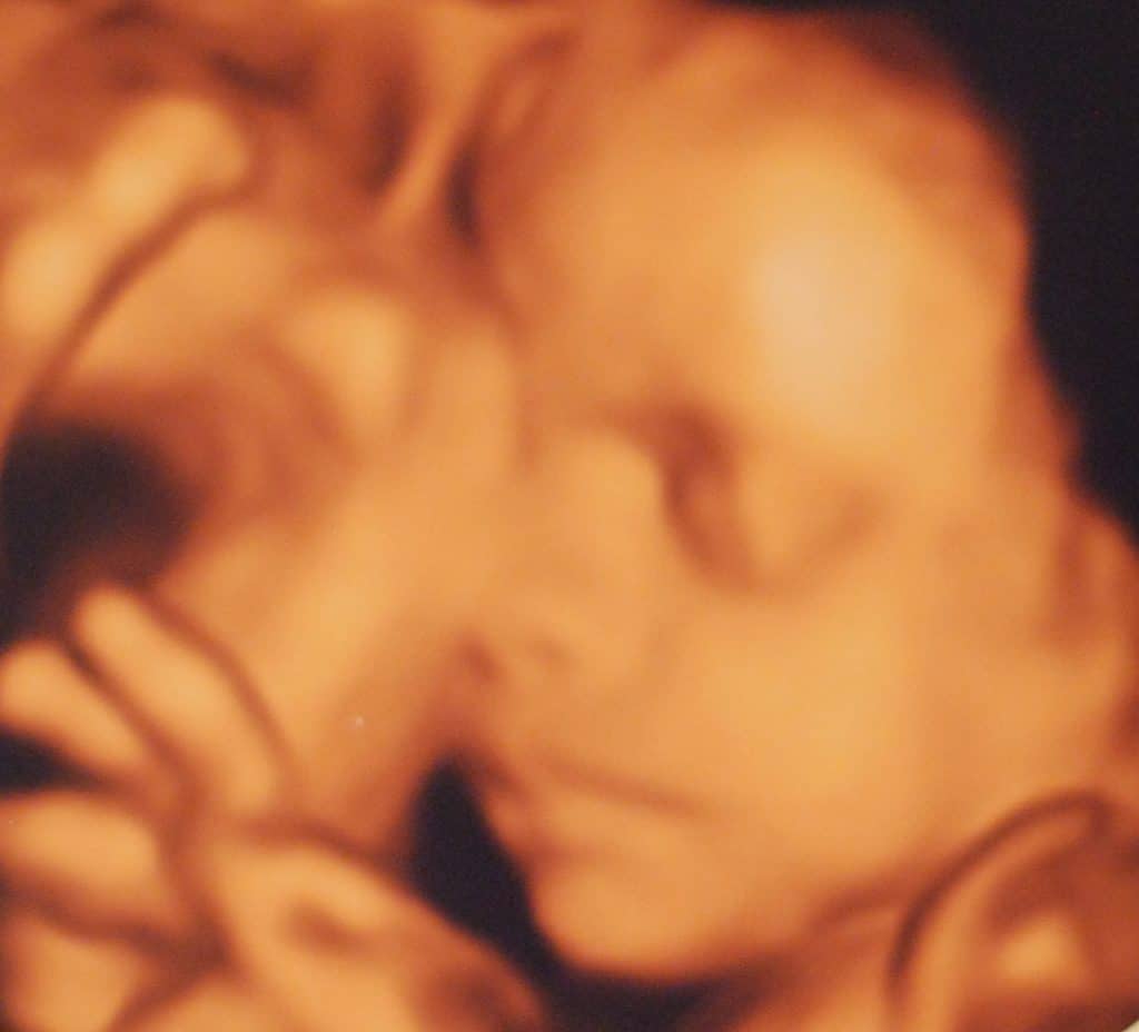 I'm 28 weeks pregnant with twins and this is my 4D scan pic!